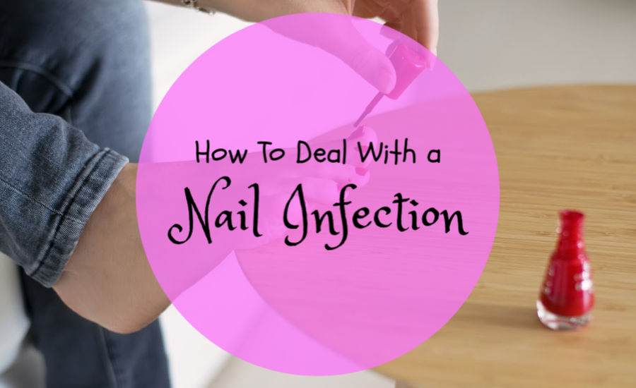 How To Deal With A Nail Infection SimpleStepsForLivingLife
